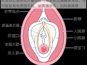 女生自己安慰后少量出血可能是处女膜破裂导致，也可能是其他原因引起，如阴道损伤、妇科疾病等