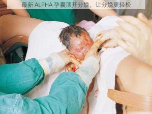 最新 ALPHA 孕囊顶开分娩，让分娩更轻松