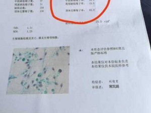 急需备孕丈夫精子，有献身取精经验的护士在线接单