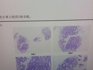 mofermagic 高端大肠交，柔软舒适，易清洗，可重复使用