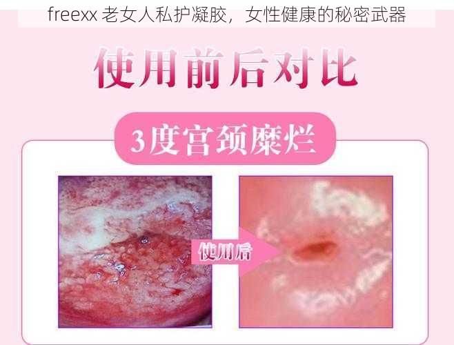 freexx 老女人私护凝胶，女性健康的秘密武器