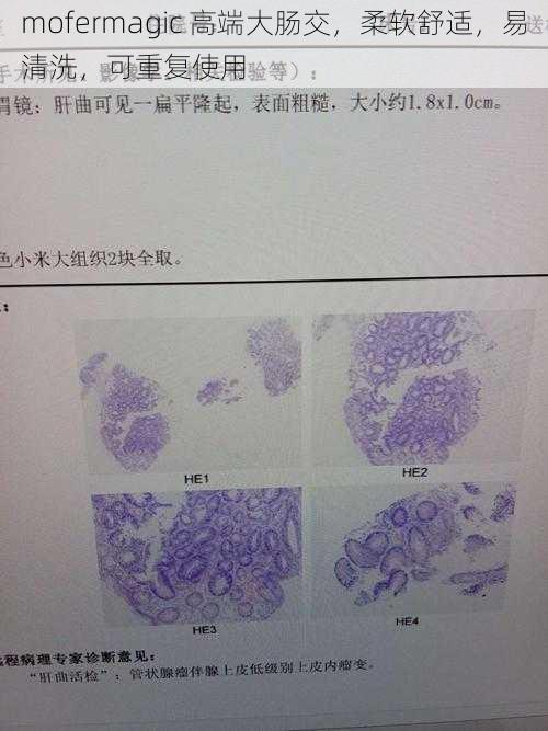 mofermagic 高端大肠交，柔软舒适，易清洗，可重复使用