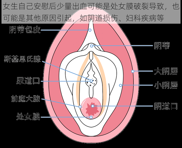 女生自己安慰后少量出血可能是处女膜破裂导致，也可能是其他原因引起，如阴道损伤、妇科疾病等